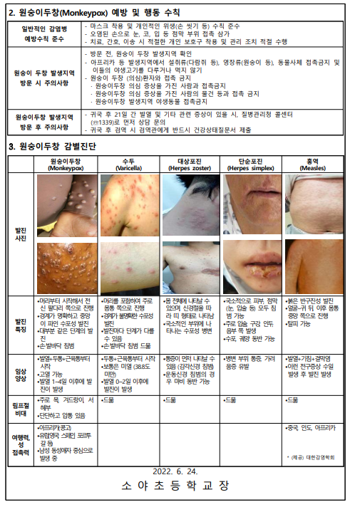 소야초등학교 :: 가정통신문 :: 원숭이두창 예방 및 행동수칙 안내