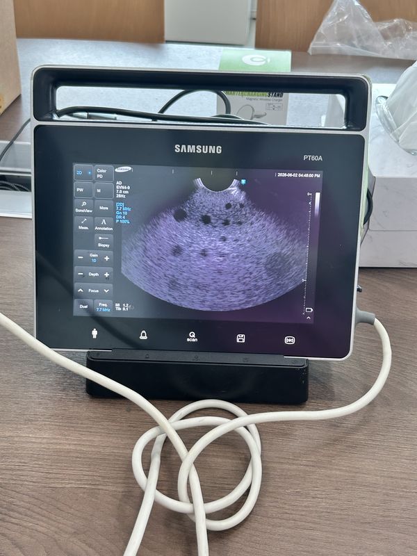 삼성 메디슨 UGEO PT60A 의료용 초음파 진단기